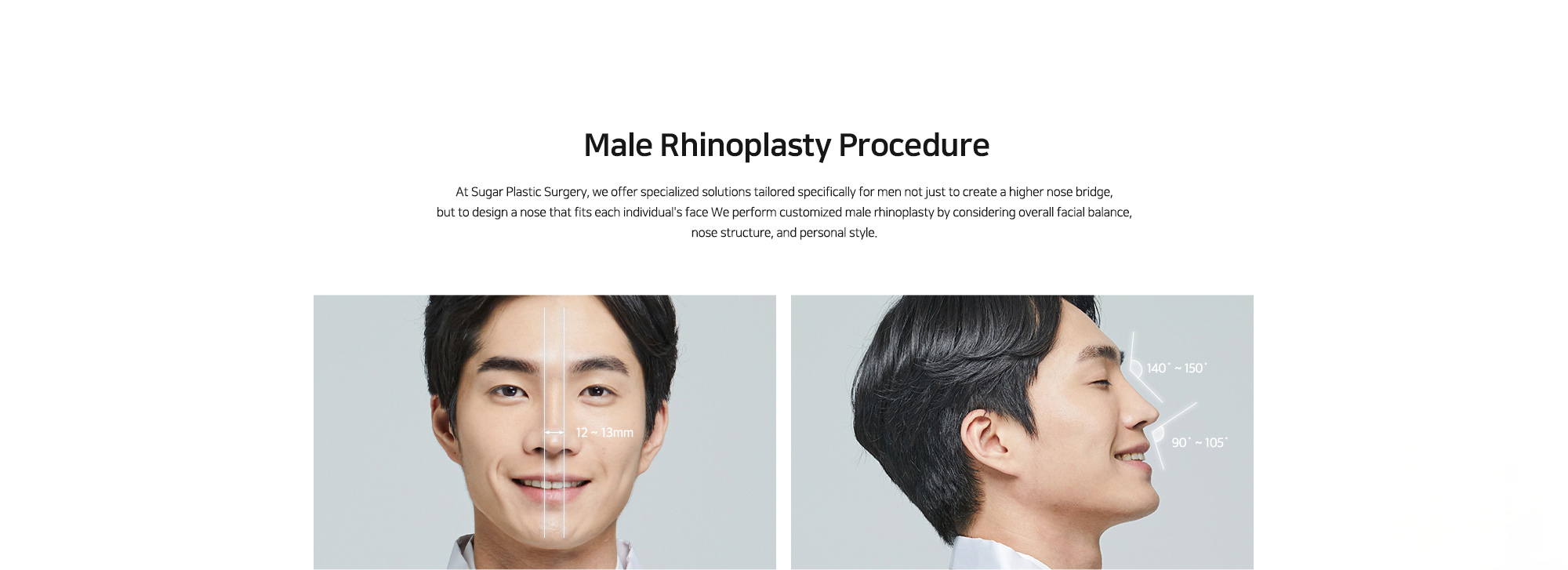 [Male Rhinoplasty Procedure] At Sugar Plastic Surgery, we offer specialized solutions tailored specifically for men not just to create a higher nose bridge, but to design a nose that fits each individual's face We perform customized male rhinoplasty by considering overall facial balance, nose structure, and personal style.