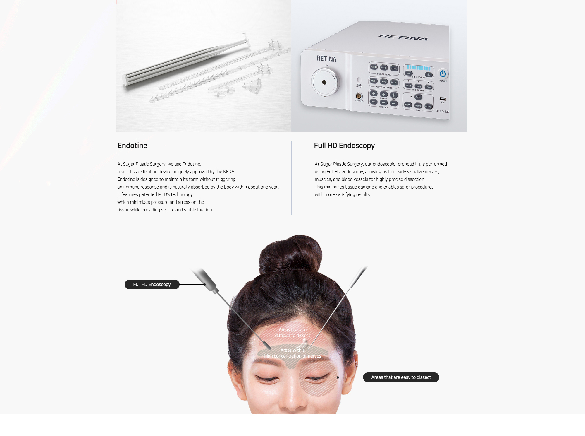 [Endotine] At Sugar Plastic Surgery, we use Endotine, a soft tissue fixation device uniquely approved by the KFDA. Endotine is designed to maintain its form without triggering an immune response and is naturally absorbed by the body within about one year. It features patented MTDS technology, which minimizes pressure and stress on the tissue while providing secure and stable fixation. [Full HD Endoscopy] At Sugar Plastic Surgery, our endoscopic forehead lift is performed using Full HD endoscopy, allowing us to clearly visualize nerves, muscles, and blood vessels for highly precise dissection. This minimizes tissue damage and enables safer procedures with more satisfying results.