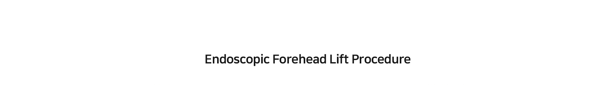 [Endoscopic Forehead Lift Procedure] 