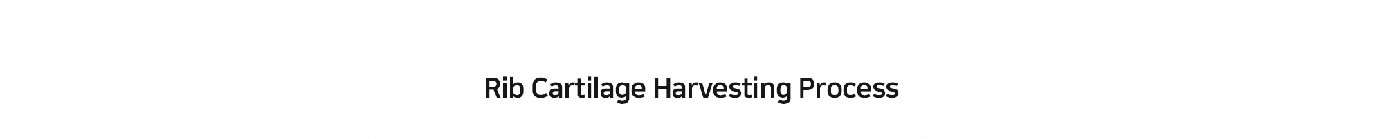 [Rib Cartilage Harvesting Process] 