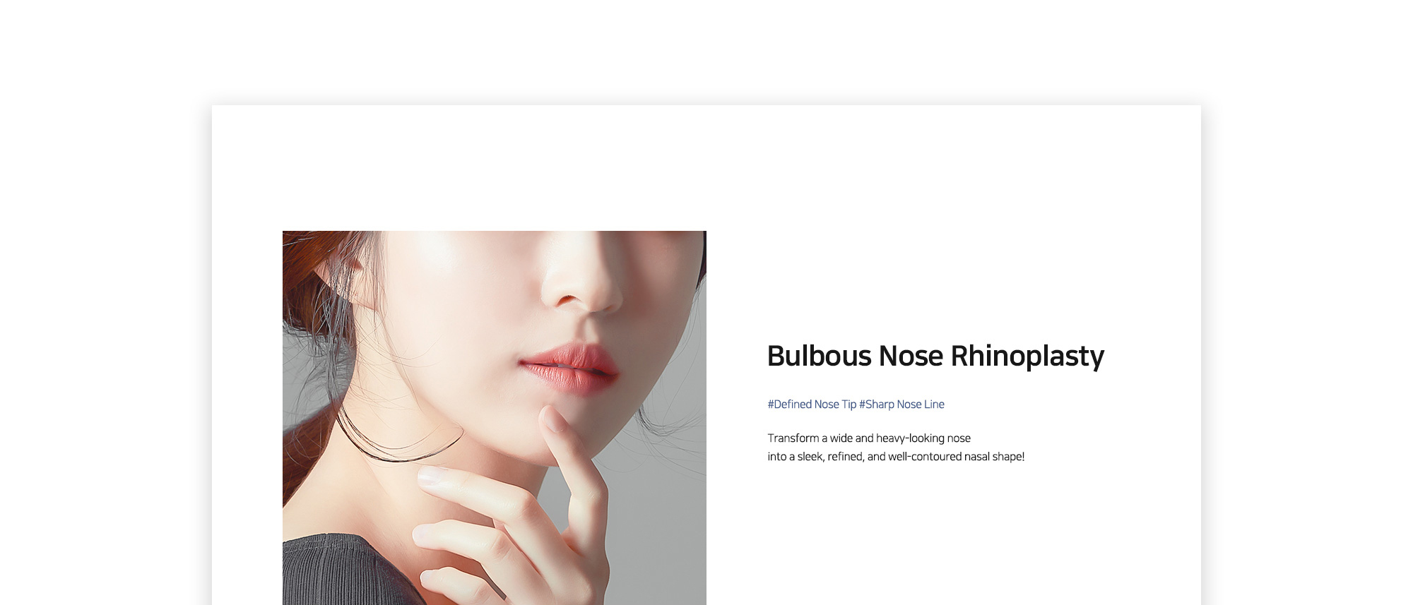 [Bulbous Nose Rhinoplasty] #Defined Nose Tip #Sharp Nose Line