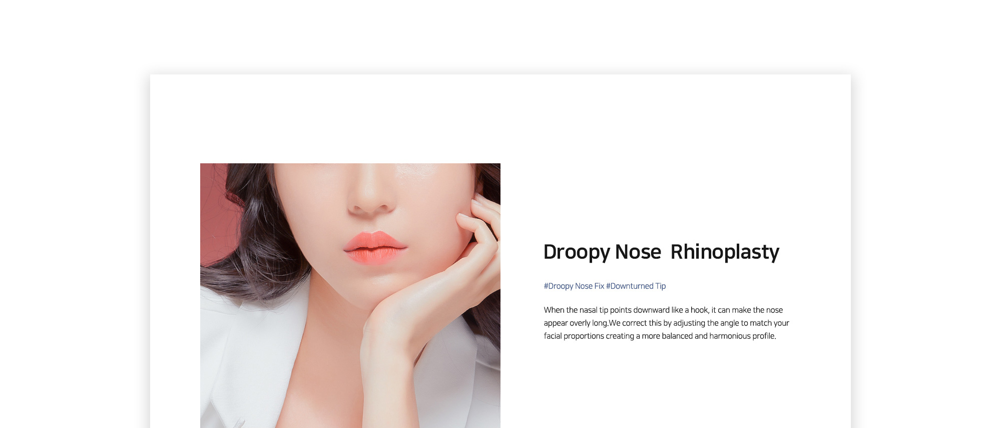 [Droopy Nose  Rhinoplasty] #Droopy Nose Fix #Downturned Tip