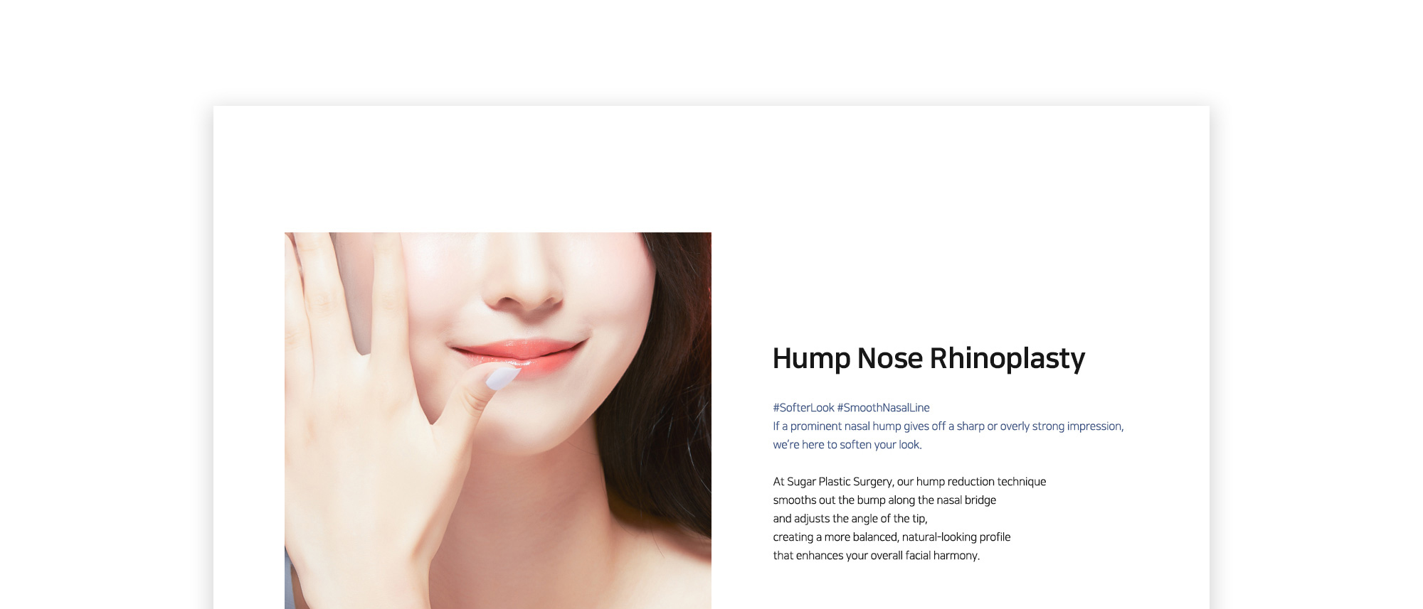 [Hump Nose Rhinoplasty] #SofterLook #SmoothNasalLine If a prominent nasal hump gives off a sharp or overly strong impression, we’re here to soften your look.