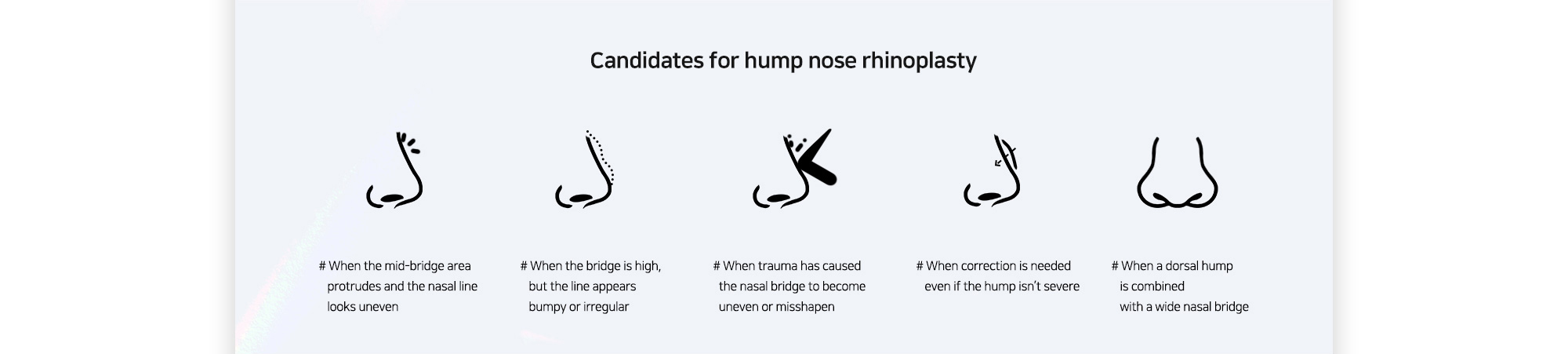 [Candidates for hump nose rhinoplasty] # When the mid-bridge area protrudes and the nasal line looks uneven # When the bridge is high, but the line appears bumpy or irregular # When trauma has caused the nasal bridge to become uneven or misshapen # When correction is needed even if the hump isn’t severe # When a dorsal hump is combined with a wide nasal bridge