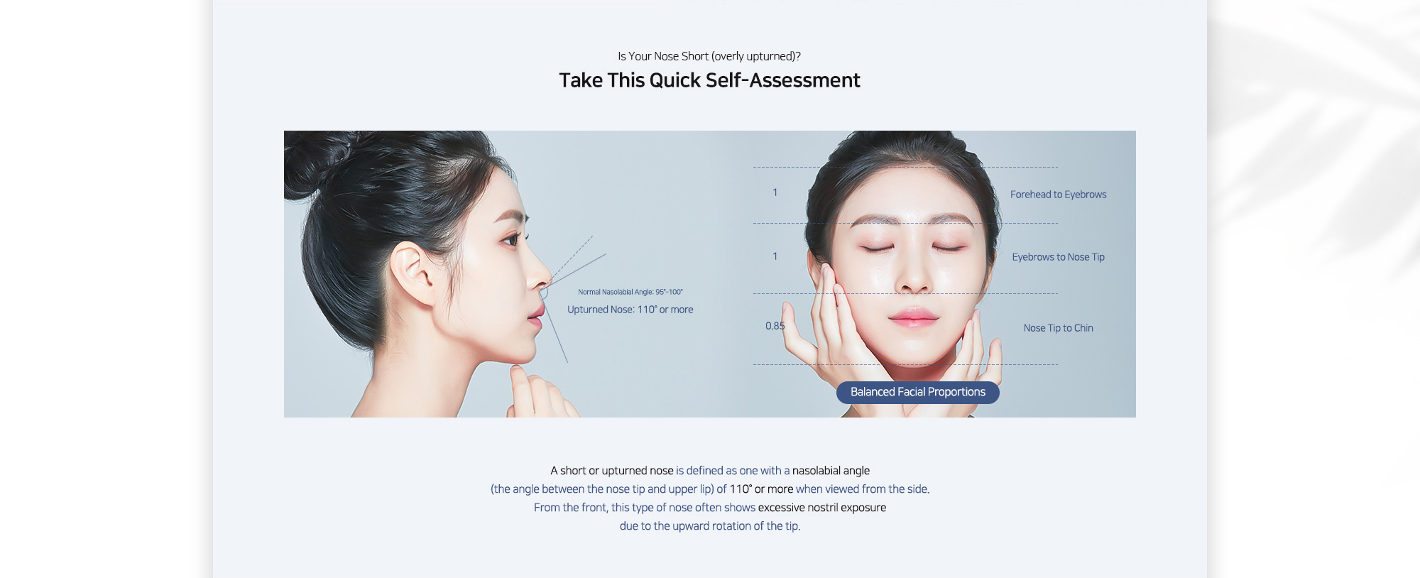 [Take This Quick Self-Assessment] A short or upturned nose is defined as one with a nasolabial angle (the angle between the nose tip and upper lip) of 110° or more when viewed from the side. From the front, this type of nose often shows excessive nostril exposure due to the upward rotation of the tip.