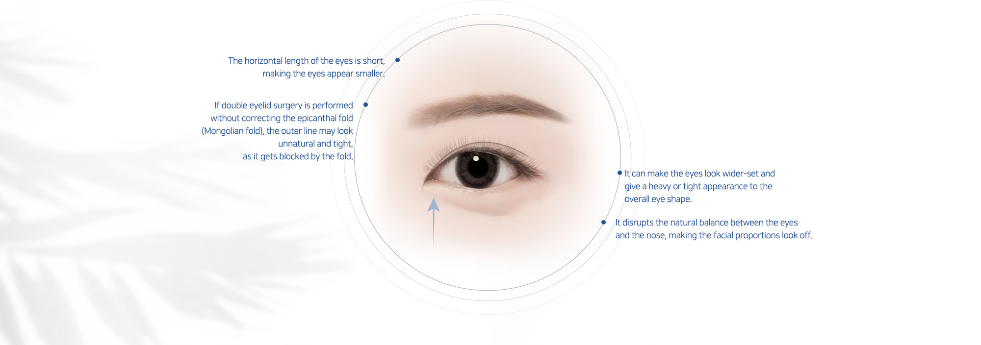 # The horizontal length of the eyes is short, making the eyes appear smaller.   # If double eyelid surgery is performed without correcting the epicanthal fold (Mongolian fold), the outer line may look unnatural and tight, as it gets blocked by the fold.   # It can make the eyes look wider-set and give a heavy or tight appearance to the overall eye shape.   # It disrupts the natural balance between the eyes and the nose, making the facial proportions look off.